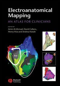 Produktbild: Electroanatomical Mapping