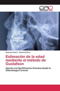 Produktbild: Estimaci&oacute;n de la edad mediante el m&eacute;todo de Gustafson