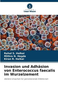 Produktbild: Invasion und Adh&auml;sion von Enterococcus faecalis im Wurzelzement