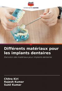 Produktbild: Diff&eacute;rents mat&eacute;riaux pour les implants dentaires