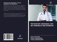 Produktbild: Verworven stenoses van de slokdarm bij kinderen