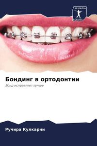 Produktbild: Bonding w ortodontii