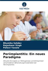 Produktbild: Periimplantitis: Ein neues Paradigma