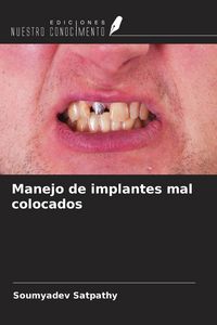Produktbild: Manejo de implantes mal colocados