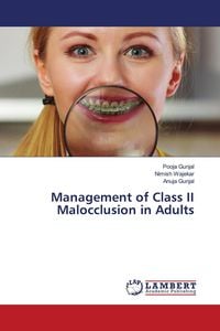 Produktbild: Management of Class II Malocclusion in Adults
