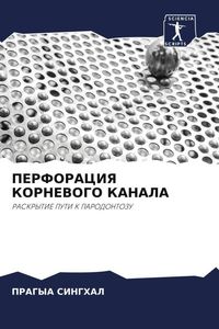 Produktbild: Perforaciya Kornevogo Kanala