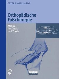 Produktbild: Orthop&auml;dische Fu&szlig;chirurgie