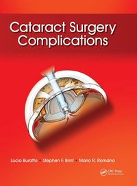Produktbild: Cataract Surgery Complications