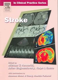 Produktbild: Stroke