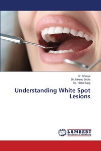 Produktbild: Understanding White Spot Lesions