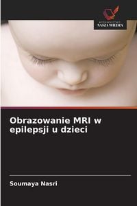 Produktbild: Obrazowanie MRI w epilepsji u dzieci