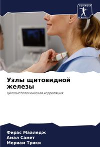 Produktbild: Uzly schitowidnoj zhelezy
