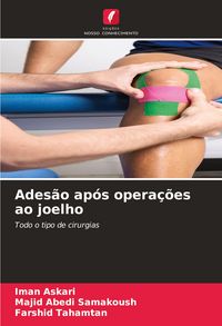 Produktbild: Ades&atilde;o ap&oacute;s opera&ccedil;&otilde;es ao joelho