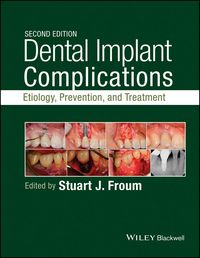 Produktbild: Dental Implant Complications