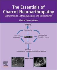 Produktbild: Pierre-Jerome, C: The Essentials of Charcot Neuroarthropathy