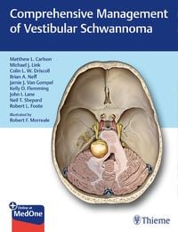Produktbild: Comprehensive Management of Vestibular Schwannoma