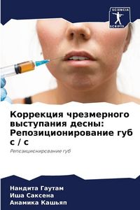 Produktbild: Korrekciq chrezmernogo wystupaniq desny: Repozicionirowanie gub s / s