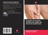Produktbild: O efeito da terapia TECAR nas les&otilde;es do m&uacute;sculo quadr&iacute;ceps