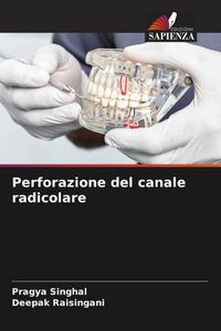 Produktbild: Perforazione del canale radicolare