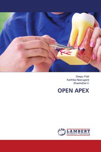 Produktbild: Open Apex