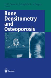 Produktbild: Bone Densitometry and Osteoporosis