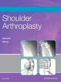 Produktbild: Shoulder Arthroplasty E-Book