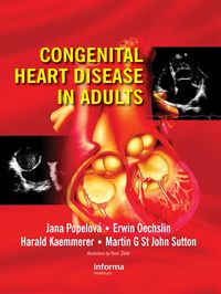 Produktbild: Congenital Heart Disease in Adults