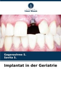 Produktbild: Implantat in der Geriatrie