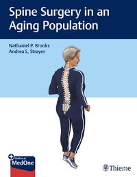 Produktbild: Spine Surgery in an Aging Population