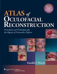 Produktbild: Atlas Of Oculofacial Reconstru