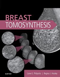 Produktbild: Breast Tomosynthesis E-Book