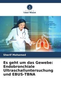 Produktbild: Es geht um das Gewebe: Endobronchiale Ultraschalluntersuchung und EBUS-TBNA