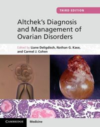 Produktbild: Altchek's Diagnosis and Management of Ovarian Disorders