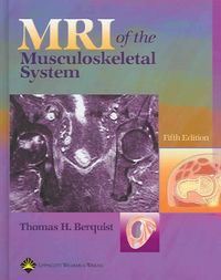 Produktbild: MRI of the Musculoskeletal System
