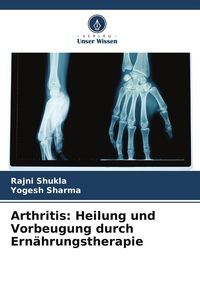 Produktbild: Arthritis: Heilung und Vorbeugung durch Ern&auml;hrungstherapie