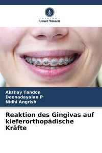 Produktbild: Reaktion des Gingivas auf kieferorthop&auml;dische Kr&auml;fte