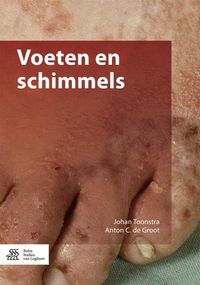 Produktbild: Voeten en schimmels