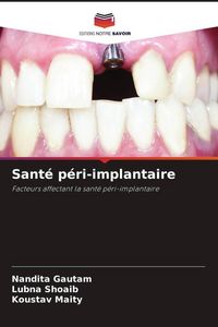 Produktbild: Sant&eacute; p&eacute;ri-implantaire