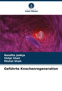 Produktbild: Gef&uuml;hrte Knochenregeneration