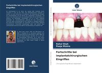 Produktbild: Fortschritte bei implantatchirurgischen Eingriffen