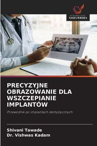 Produktbild: Precyzyjne Obrazowanie Dla Wszczepianie Implant&oacute;w