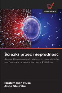 Produktbild: &iquest;cie&iquest;ki przez niep&iquest;odno&iquest;&iquest;