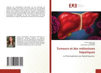 Produktbild: Tumeurs et des m&eacute;tastases h&eacute;patiques