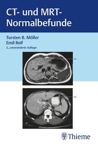 Produktbild: CT und MRT Normalbefunde
