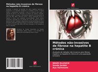Produktbild: M&eacute;todos n&atilde;o-invasivos de fibrose na hepatite B cr&oacute;nica