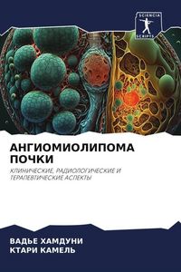 Produktbild: Angiomiolipoma Pochki