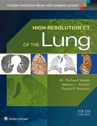 Produktbild: Webb, W: High-Resolution CT of the Lung