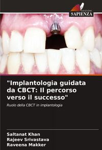 Produktbild: "Implantologia guidata da CBCT: Il percorso verso il successo"
