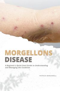 Produktbild: Morgellons Disease