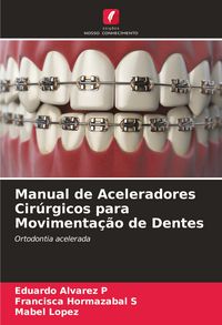 Produktbild: Manual de Aceleradores Cir&uacute;rgicos para Movimenta&ccedil;&atilde;o de Dentes